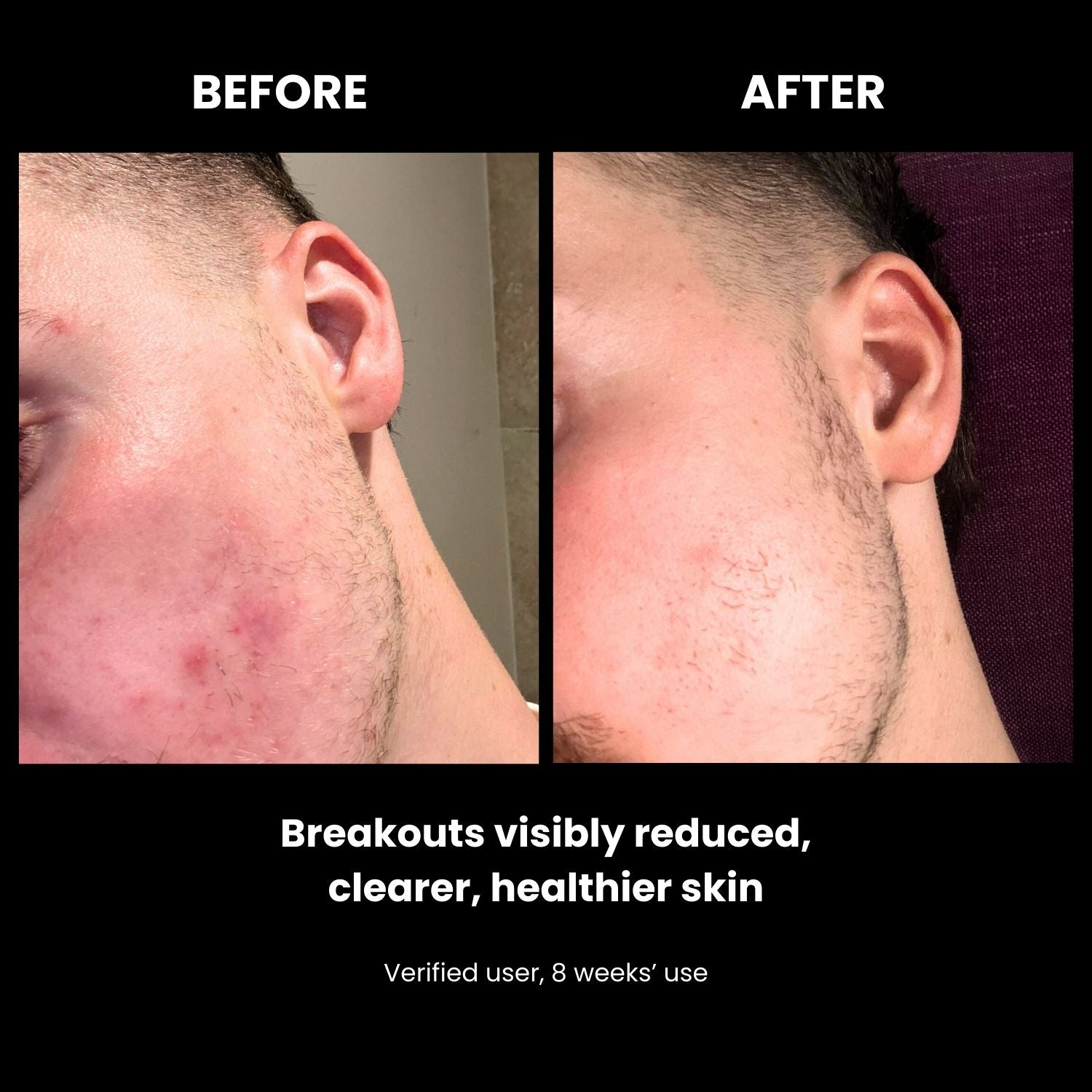 LUSTRE RENEW PRO FACEWEAR | US