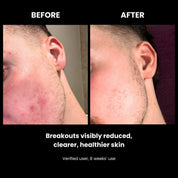 LUSTRE RENEW PRO FACEWEAR | US