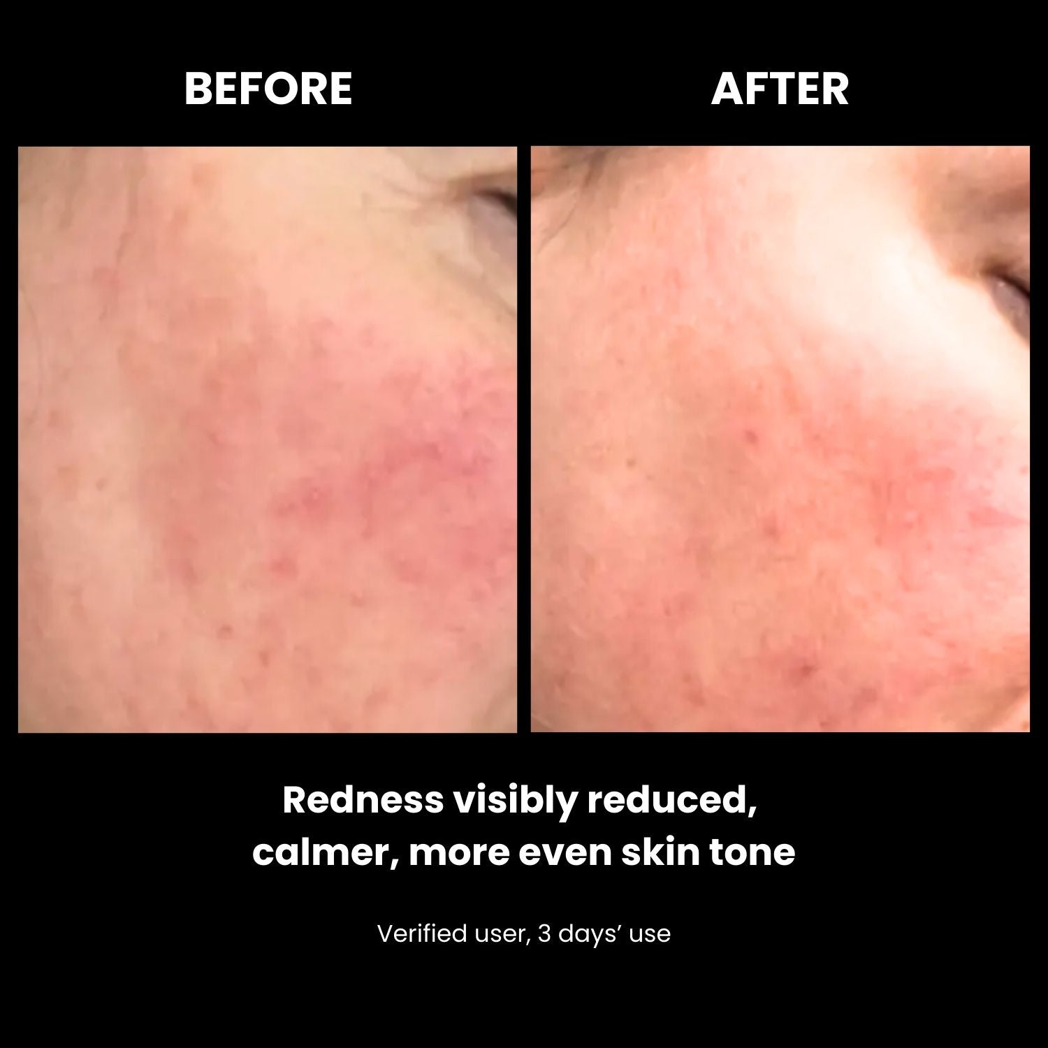 LUSTRE RENEW PRO FACEWEAR | US