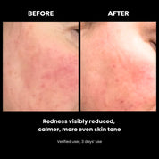 LUSTRE RENEW PRO FACEWEAR | US