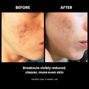 LUSTRE REVIVE LED Mask