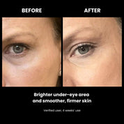 LUSTRE REVIVE LED Mask
