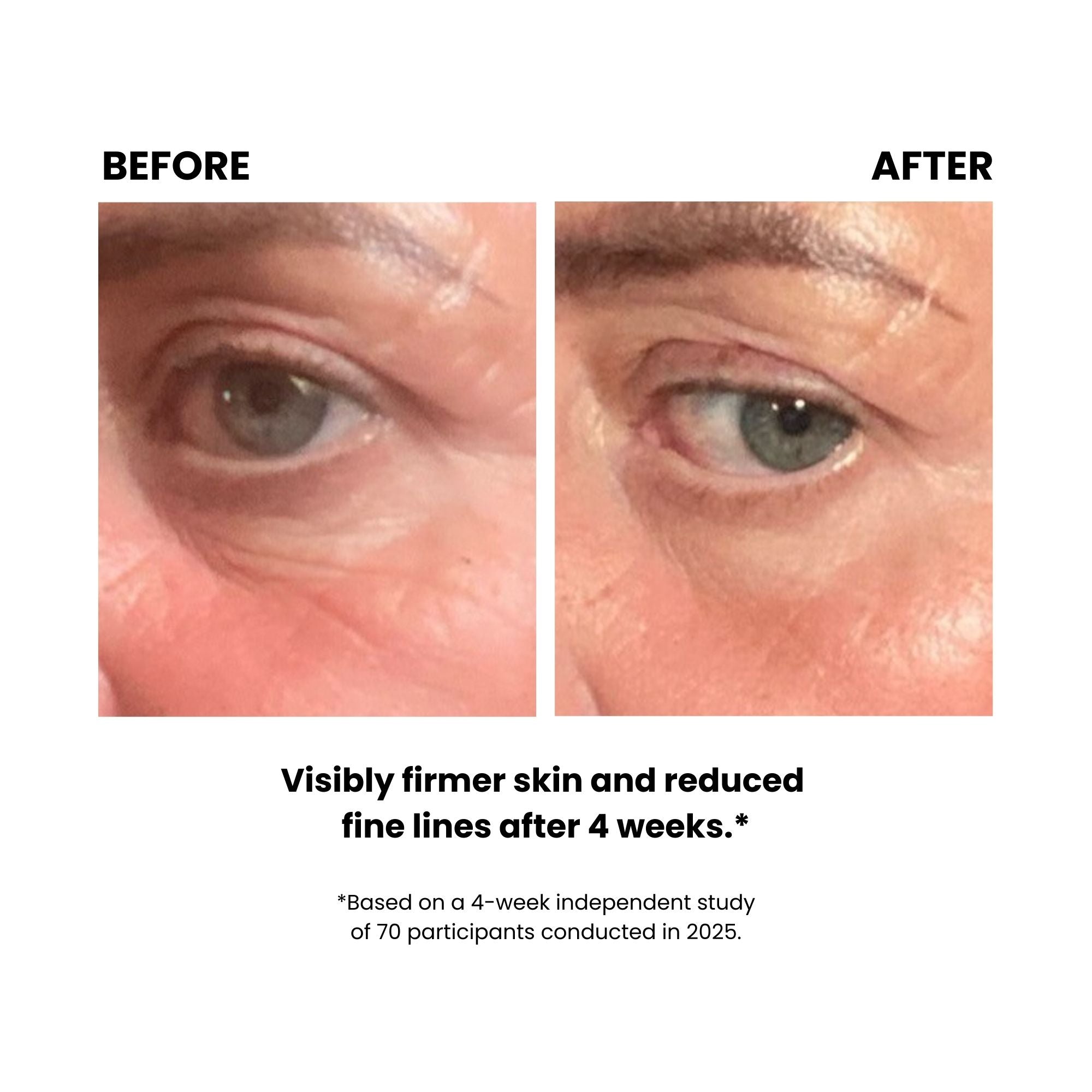 LUSTRE GoGlow Advanced LED Patches