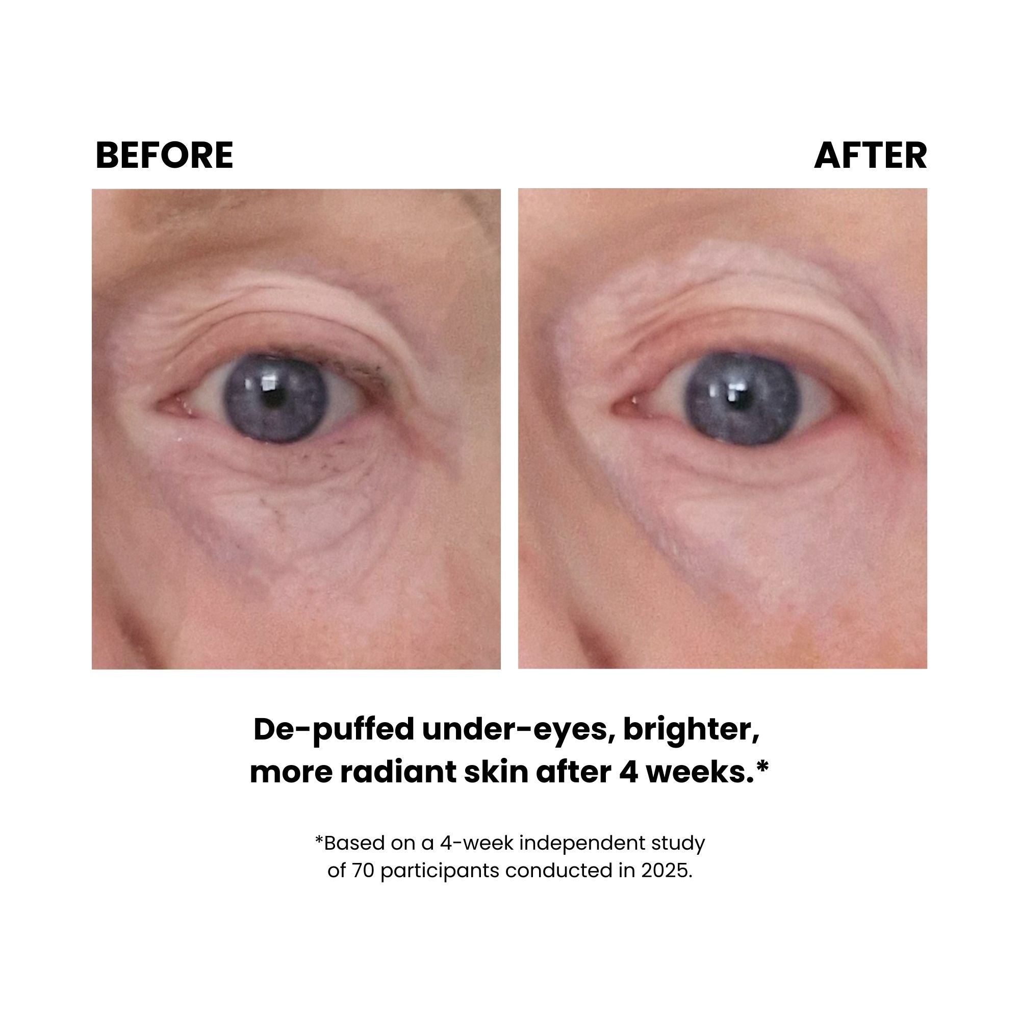 LUSTRE GoGlow Advanced LED Patches