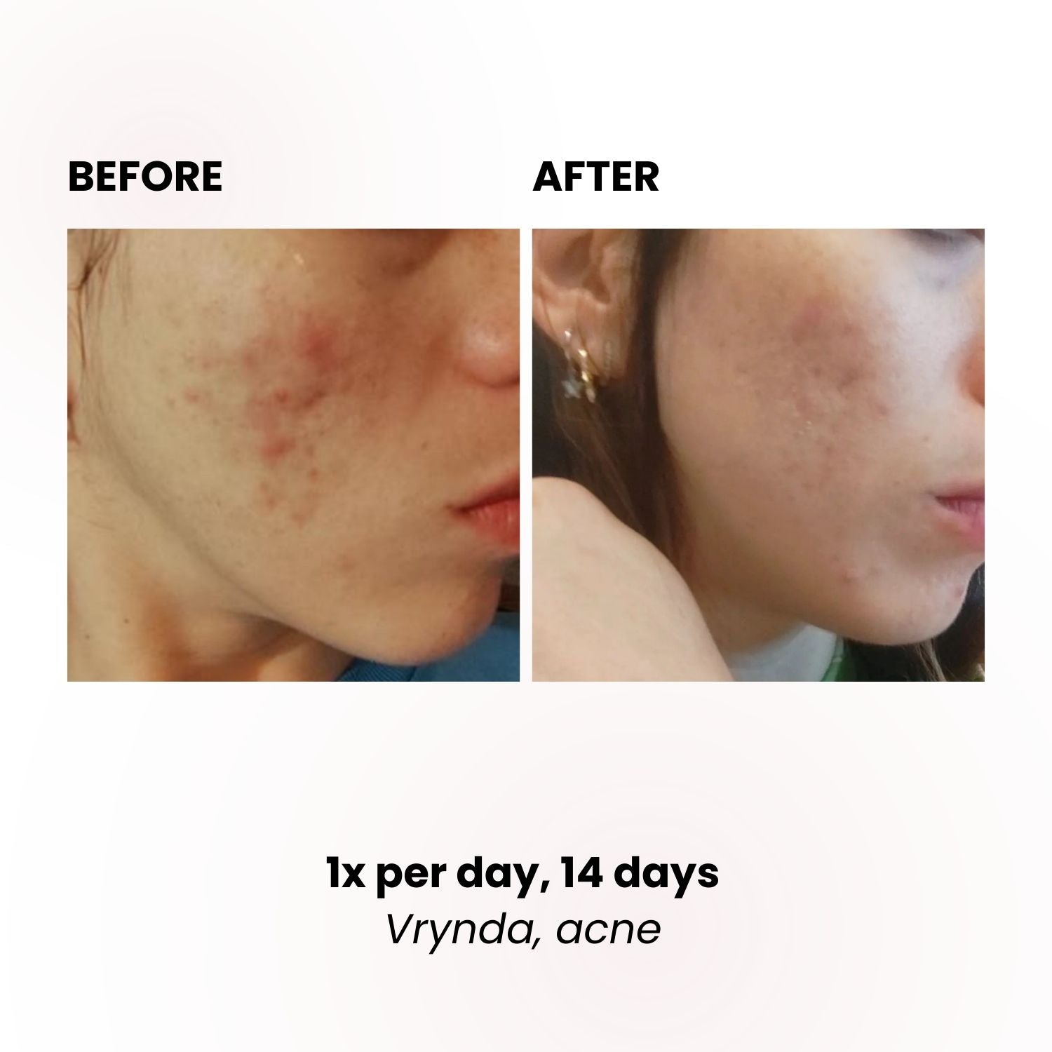 LUSTRE REVIVE LED Mask