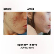 LUSTRE REVIVE LED Mask