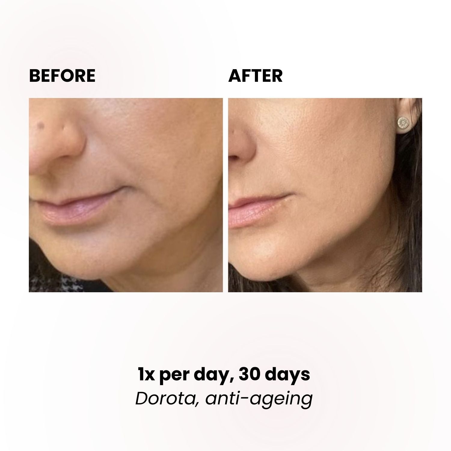 LUSTRE REVIVE LED Mask