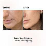 LUSTRE REVIVE LED Mask