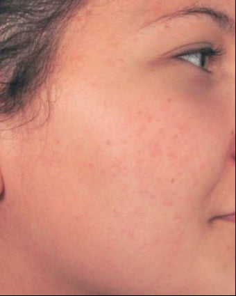 After image