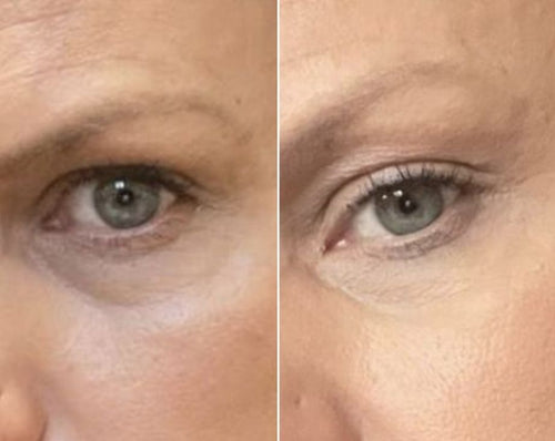 before and after thumb