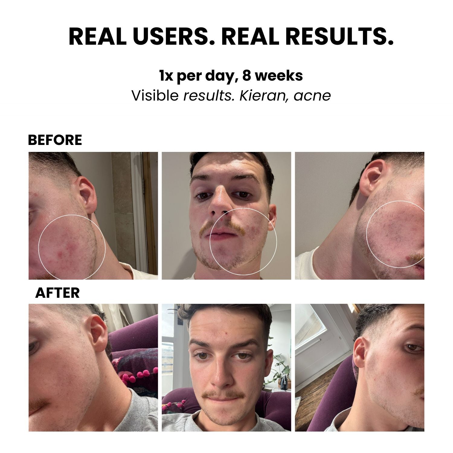 LUSTRE RENEW PRO FACEWEAR