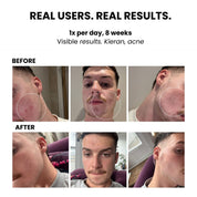 LUSTRE RENEW PRO FACEWEAR